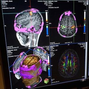 Cognitive Neuroscience and Communication Disorders