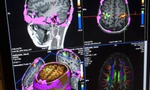 Cognitive Neuroscience and Communication Disorders